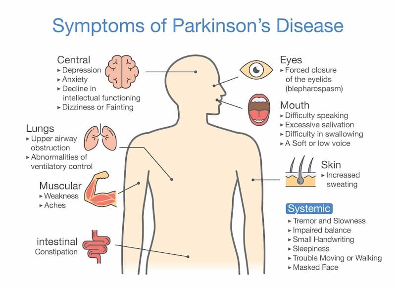 Symptoms of Parkinson’s disease
