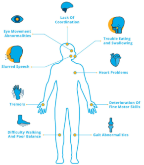 Stem Cell Treatment for Ataxia | Swiss Medica