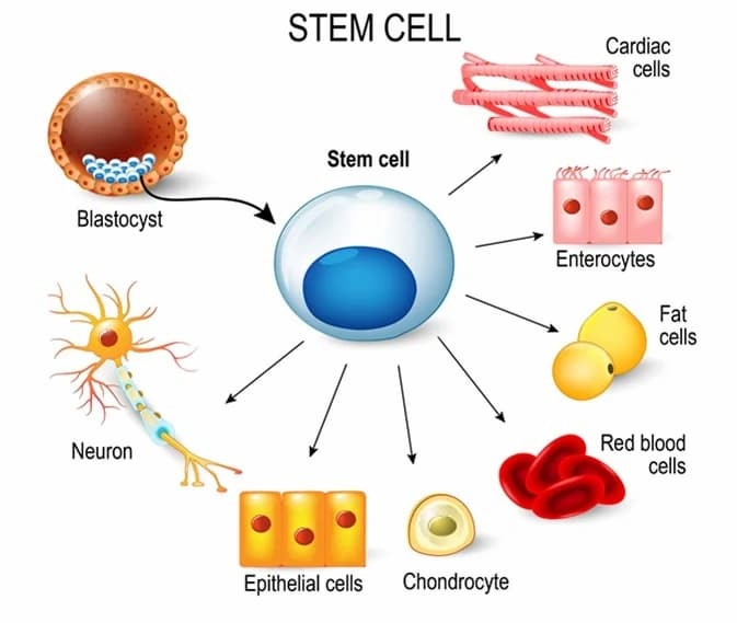 Stem Cell Therapy for Alzheimer's