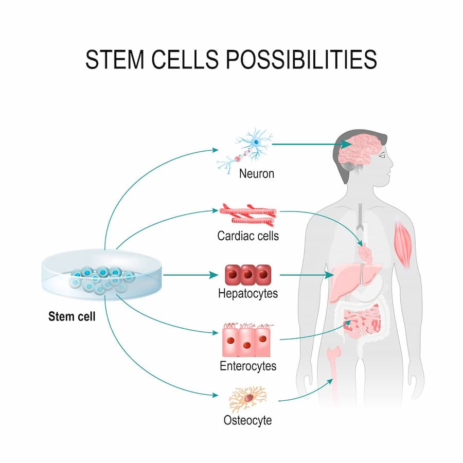 Stem Cell Treatment and Research in Australia