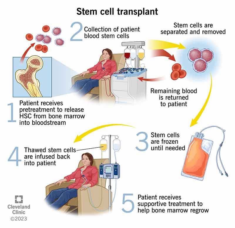 Stem Cell Treatment and Research in the Switzerland