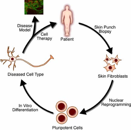 Stem Cell Treatment and Research in France