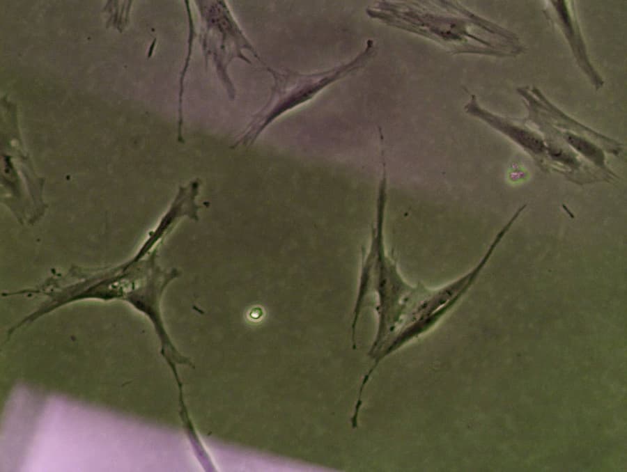 Mesenchymal Stromal Cells: A Complete Guide to Their Function and Therapeutic Applications