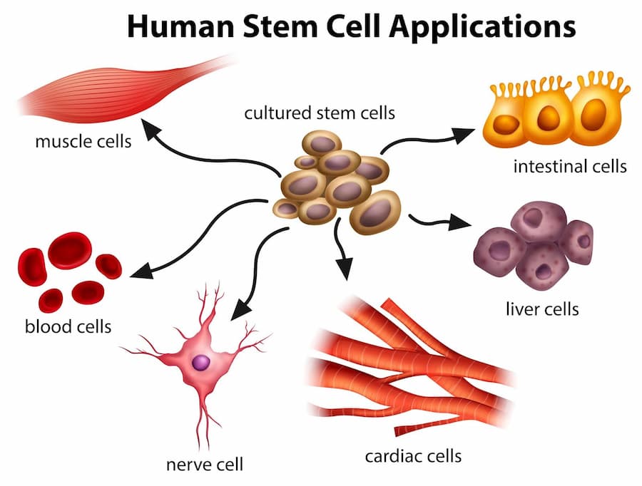 Stem Cell Therapy in Belgium