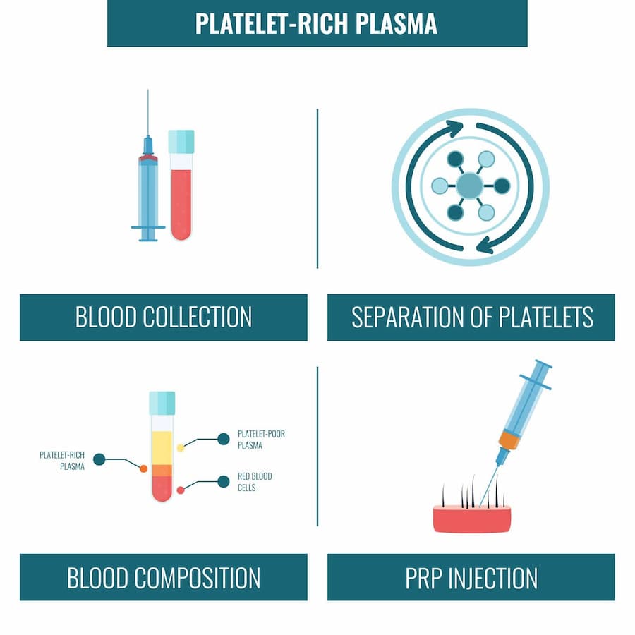 How Does PRP Therapy Work?