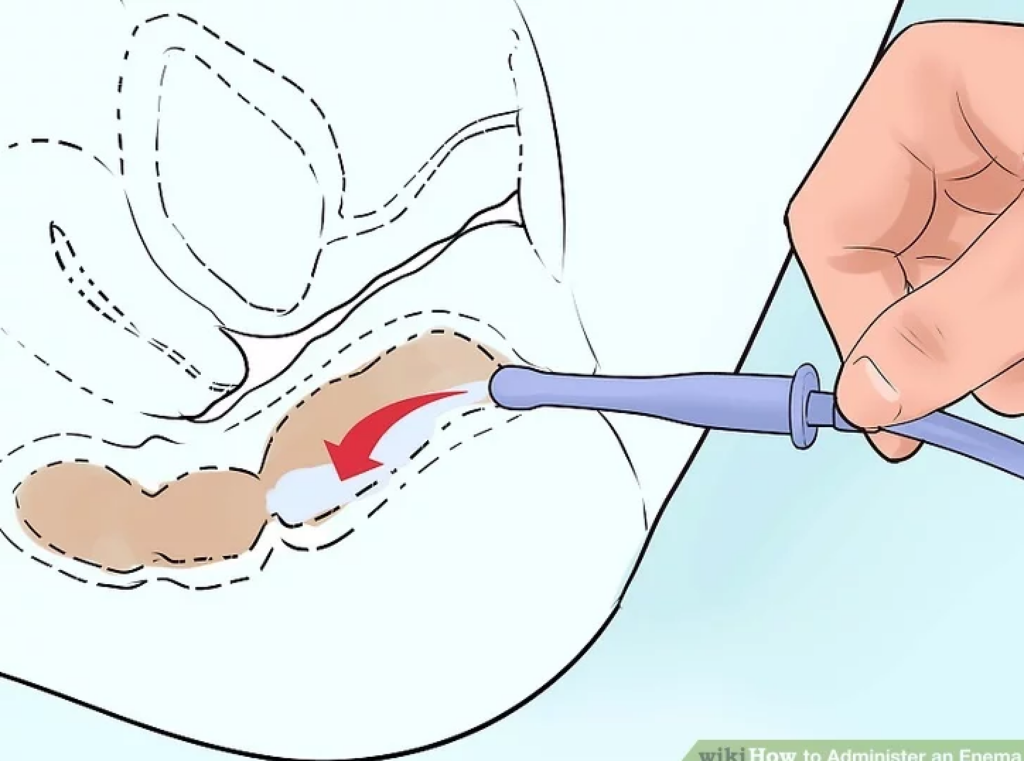 Stem Cell Delivery Methods