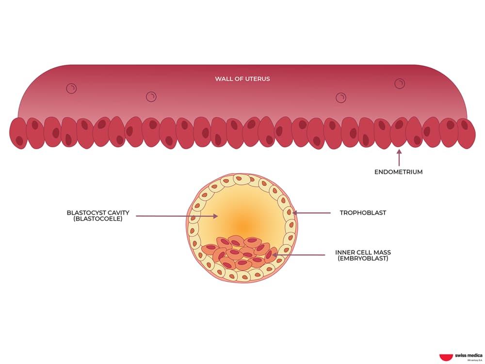 What Types of Stem Cells Are Right for the Therapy