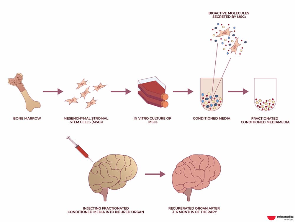 What Types of Stem Cells Are Right for the Therapy