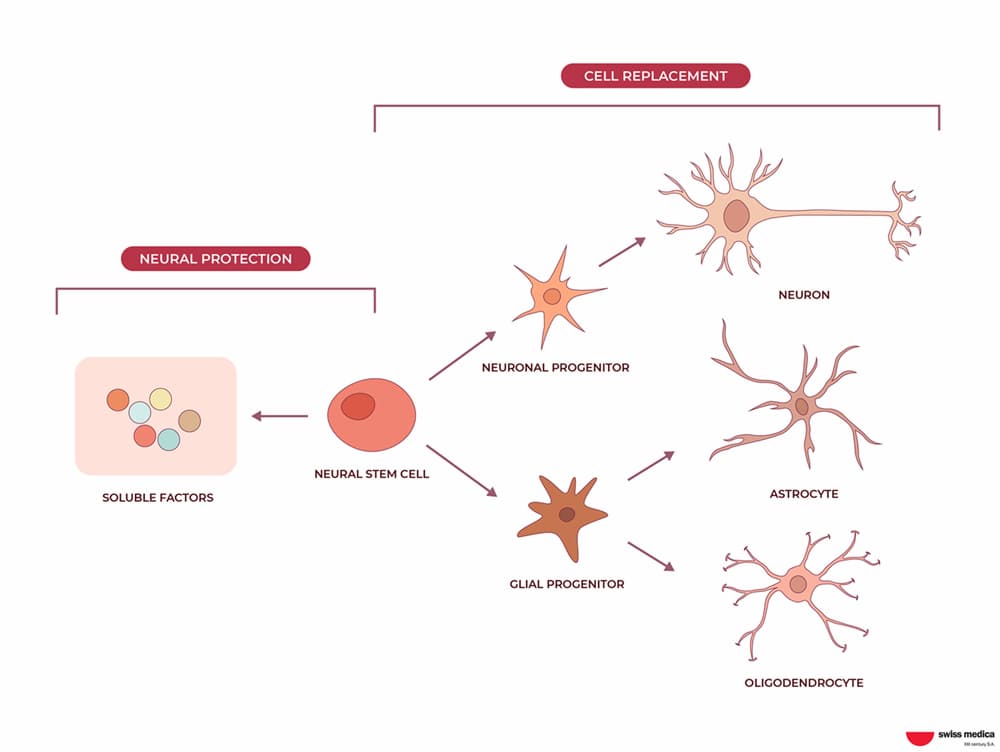 Advancements in Neurological Care with Neural Stem Cells