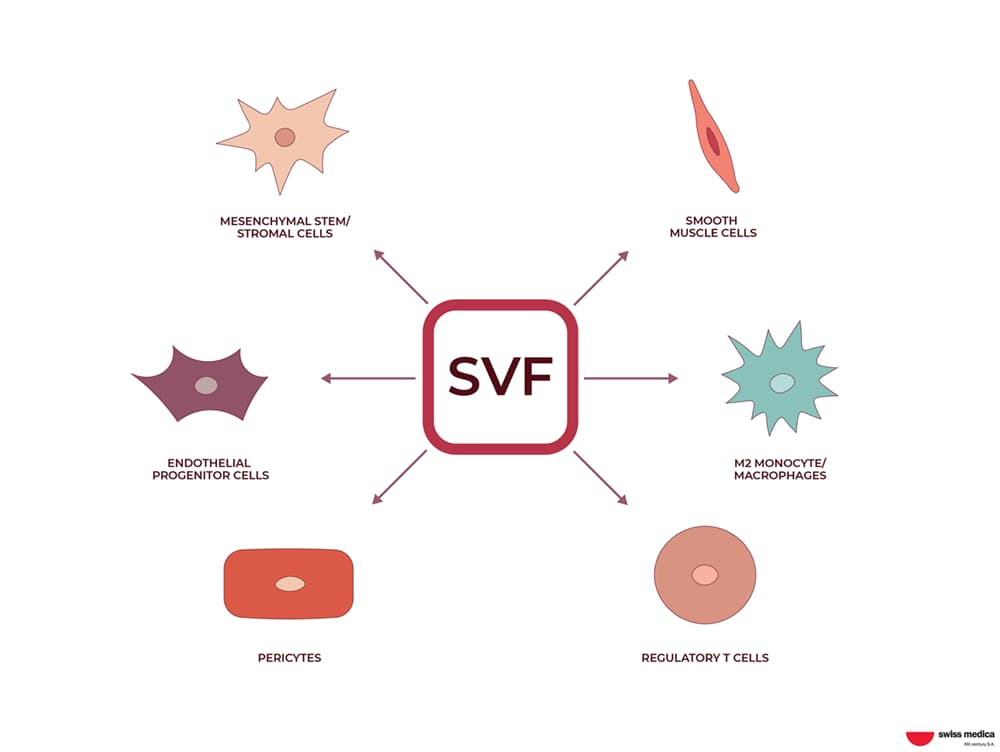 How SVF Therapy Works