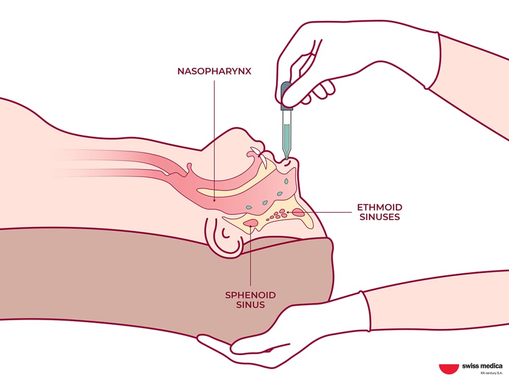 Stem Cell Delivery Methods