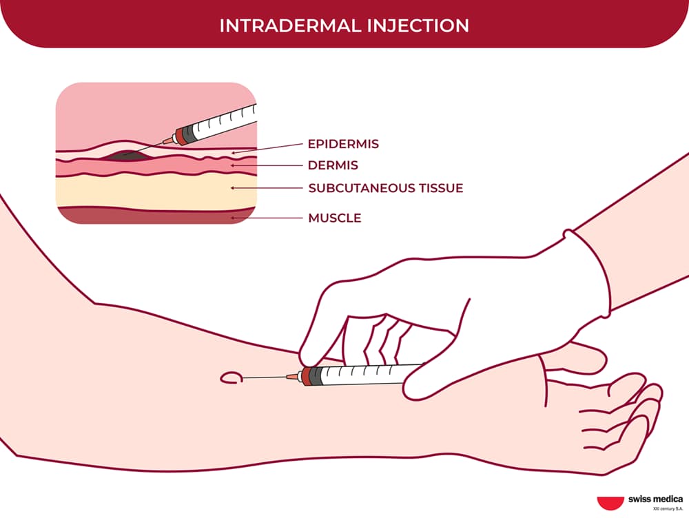 Stem Cell Delivery Methods