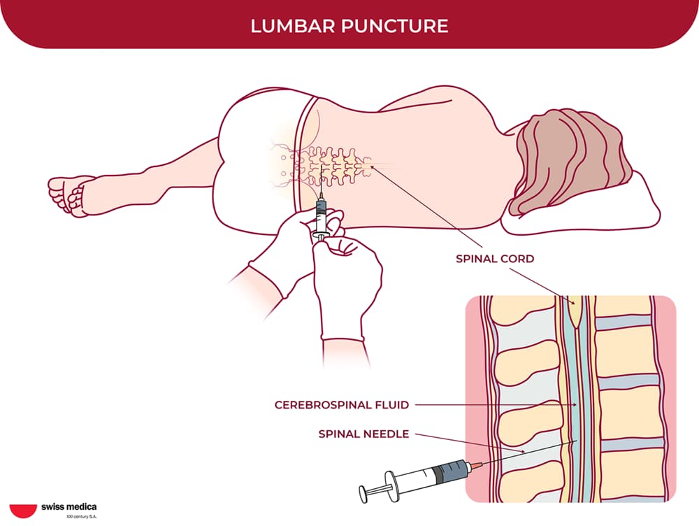 Stem Cell Delivery Methods