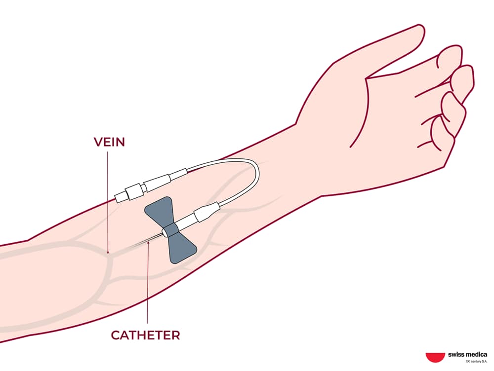 Stem Cell Delivery Methods