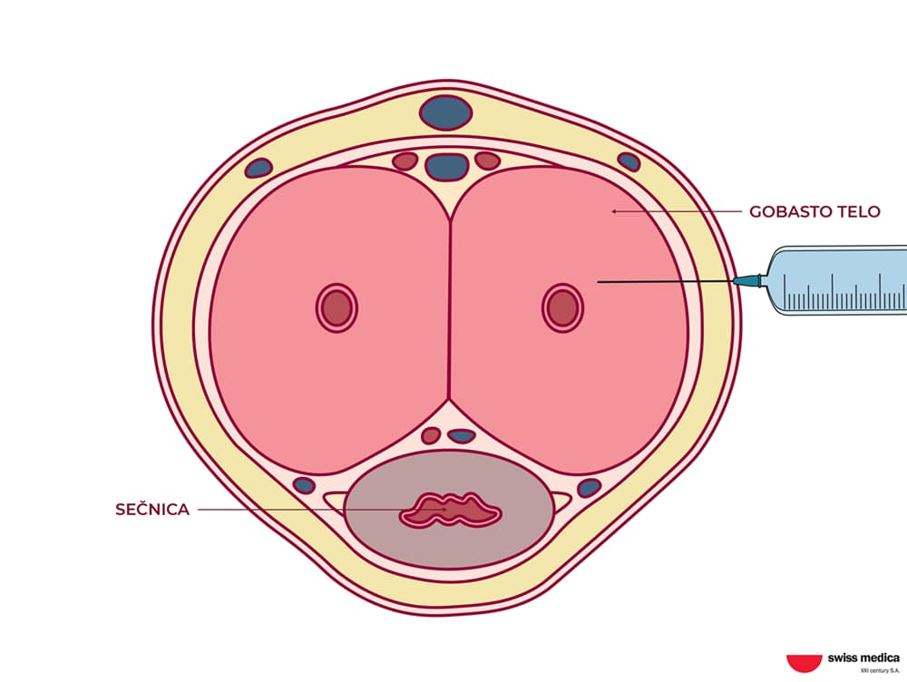 Stem Cell Delivery Methods