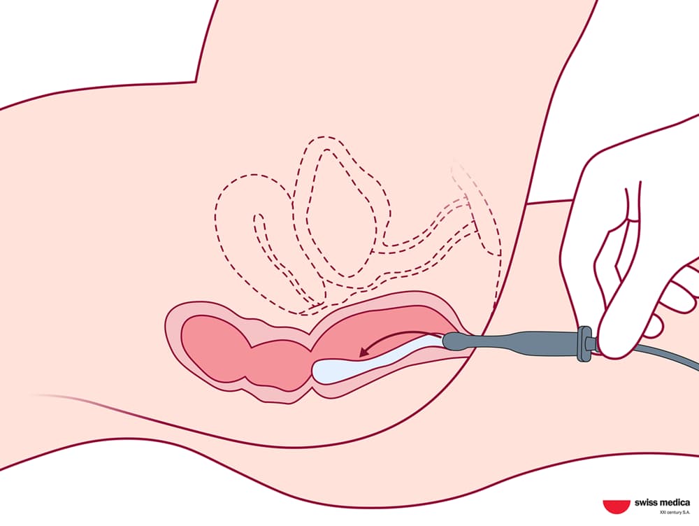 Stem Cell Delivery Methods