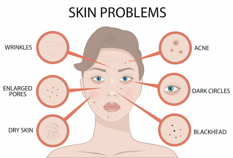 Stem Cell Therapy for Skin