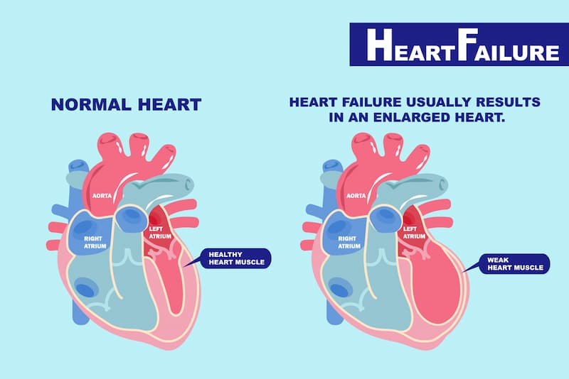 Stem Cell Therapy for Heart Failure: A Practical Guide