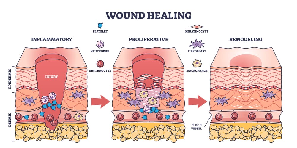 Stem Cells for Scar Treatment